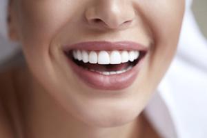 close up person smiling with straight white teeth