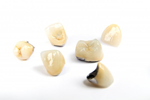 A set of dental crowns.