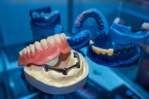 A model of a removable denture