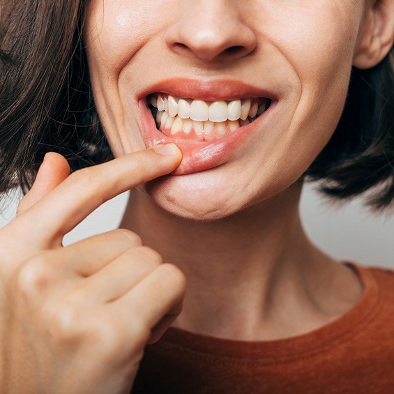 a woman pointing to inflamed gums