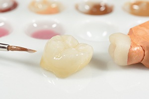 Dental crown being crafted in dental lab