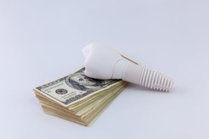 dental implant and money
