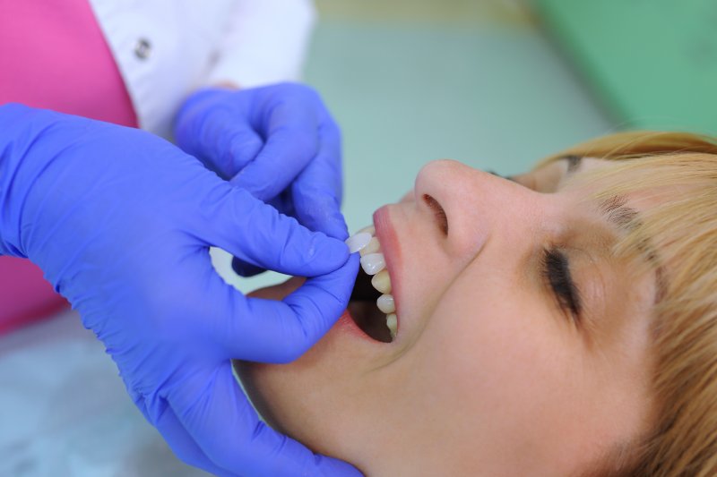 woman having veneers placed in a dental chair