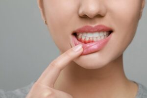 Woman pointing to red, inflamed gum. 