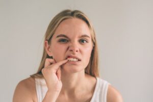 Woman exposing damaged gums.